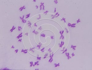 human chromosome set