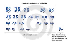Hombre cromosomas 