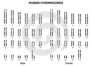Human chromosomes (human normal karyotype).