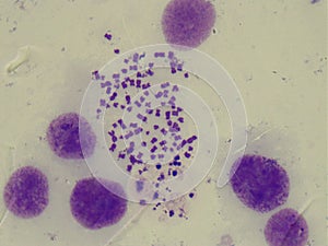 Human chromosomes under light microscope. 1000x magnification photo