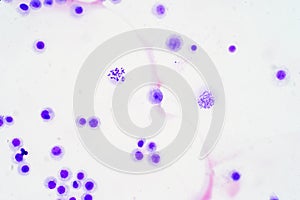Human chromosomes under microscope view