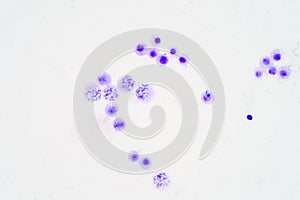 Human chromosomes under microscope view