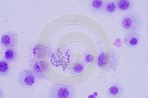 Human chromosomes under microscope view