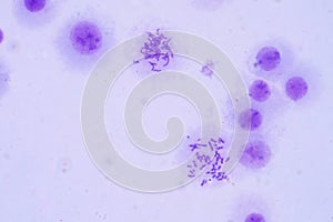 Human chromosomes under microscope view