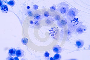 Human chromosomes under microscope view