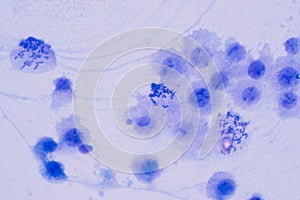 Human chromosomes under microscope view
