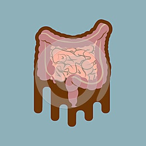 Human digestive system intestines gut anatomy gastrointestinal tract diagram. Meteorism, Enteritis, Colitis, Ulcerative Colitis, D