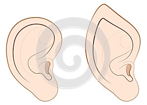 Hombre oreja puntiagudo oreja comparación 