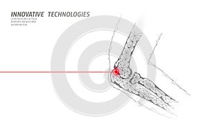 Human elbow joint 3d model vector illustration. Low poly design future technology cure pain treatment. White background