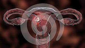 Human embryo in the uterus, scientifically accurate 3D illustration