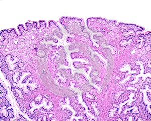 Human endocervix. Mucous glands photo