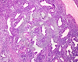 Human endometrium. Secretory phase