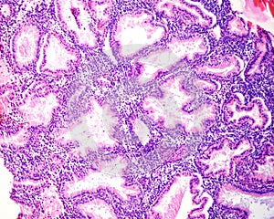 Human endometrium. Secretory phase