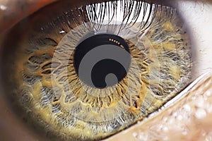 Human Eye