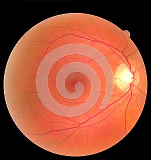 Human eye anatomy taking images with Mydriatic Retinal cameras. Examination of the eye, diabetic retinopathy, ARMD