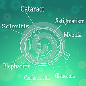 Human Eye diseases