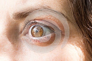 Human eye with lens close-up macro. Ophthalmology, correction of myopia or hyperopia.