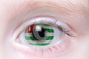 Human eye with national flag of abkhazia