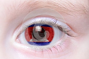 Human eye with national flag of cambodia