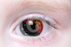 Human eye with national flag of papua new guinea