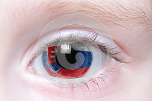 Human eye with national flag of slovakia