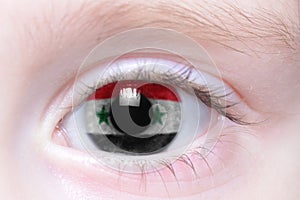 Human eye with national flag of syria