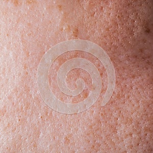 Human face skin texture