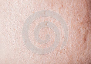 Human face skin texture