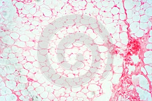 Human fat body tissue under microscope view