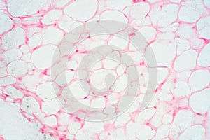 Human fat body tissue under microscope view