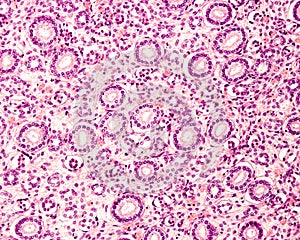 Human fetal kidney. Medulla development