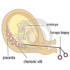 Human fetus photo