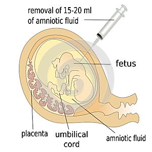 Human fetus