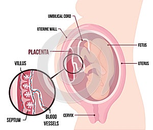 Human Fetus Placenta Anatomy. Usual anatomical Placenta Location During Pregnancy. photo