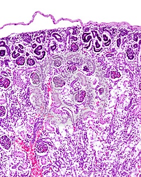 Human foetal kidney. Glomerulus development