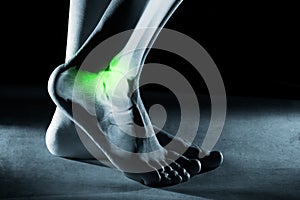 Human foot ankle and leg in x-ray, on gray background