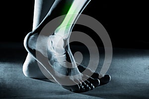 Human foot ankle and leg in x-ray, on gray background