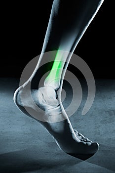 Human foot ankle and leg in x-ray, on gray background