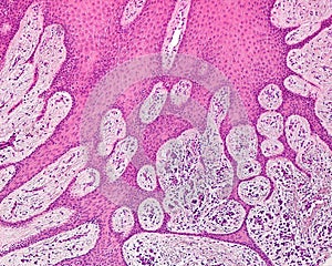 Human gingiva epithelium. Rete ridges