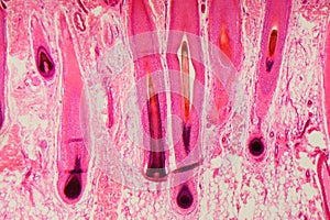 Human hair follicle in skin under the microscope