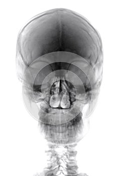 Human Head Xray Cutout