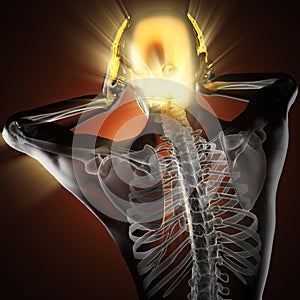 Human with headache radiography scan