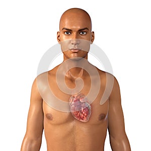 Human heart anatomy, 3D illustration. Concept of heart disease. Coronary artery disease, myocardial infarction.