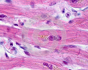 Human heart myocardium. Lipofuscin