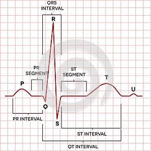 Human heart normal sinus rhythm, electrocardiogram