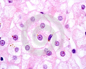 Human hepatocyte. Nucleolus