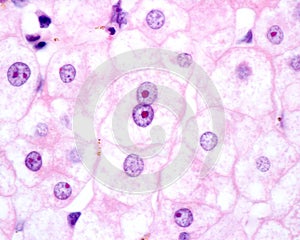 Human hepatocyte. Nucleolus