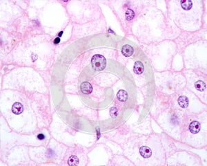 Human hepatocyte. Nucleolus