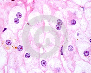 Human hepatocyte. Nucleolus