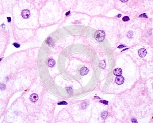 Human hepatocyte. Nucleolus